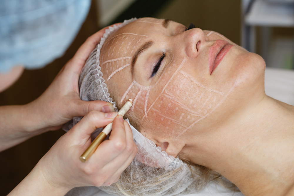 skin treatments in Udaipur