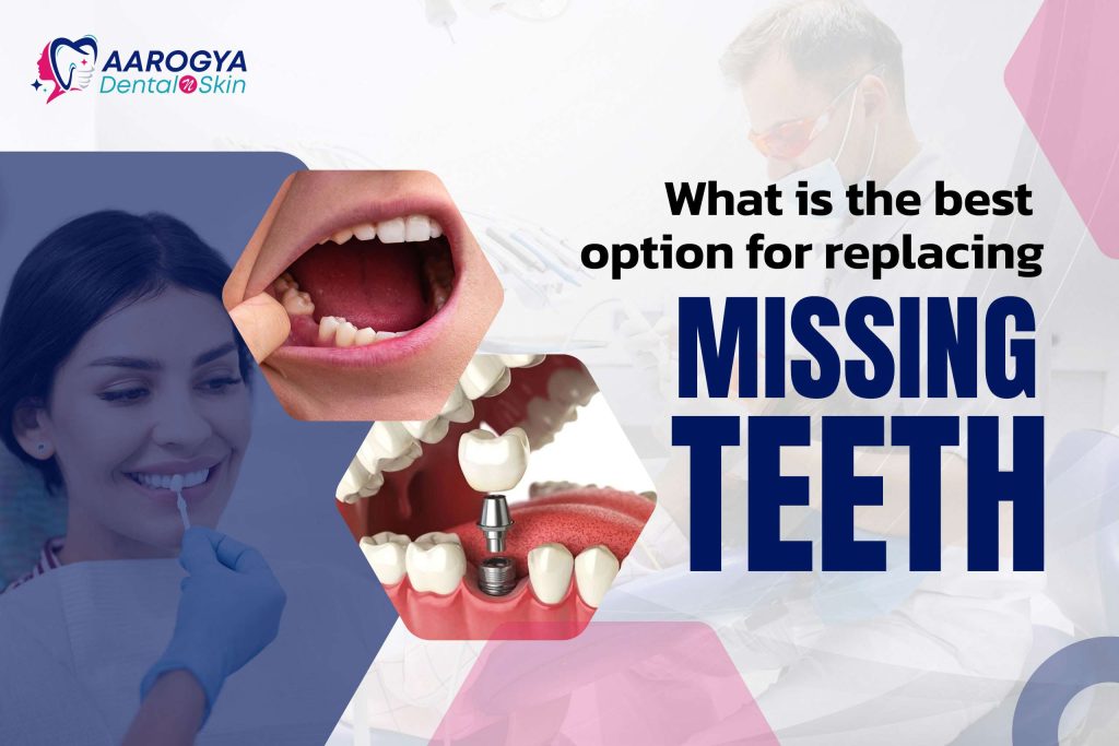 What is the best option for replacing missing teeth?