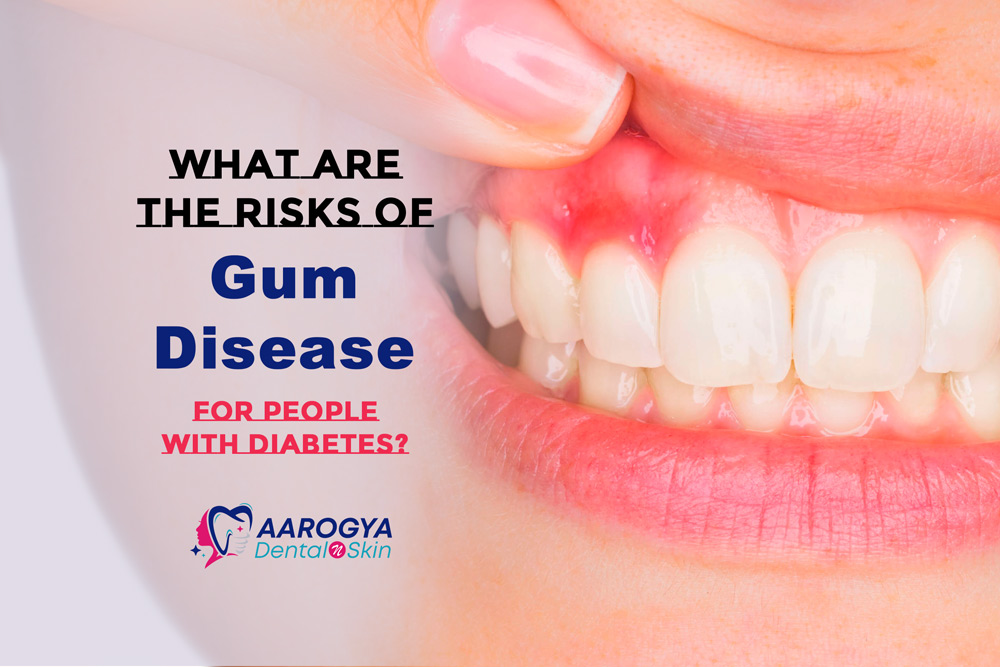 What Are the Risks of Gum Disease for People with Diabetes?